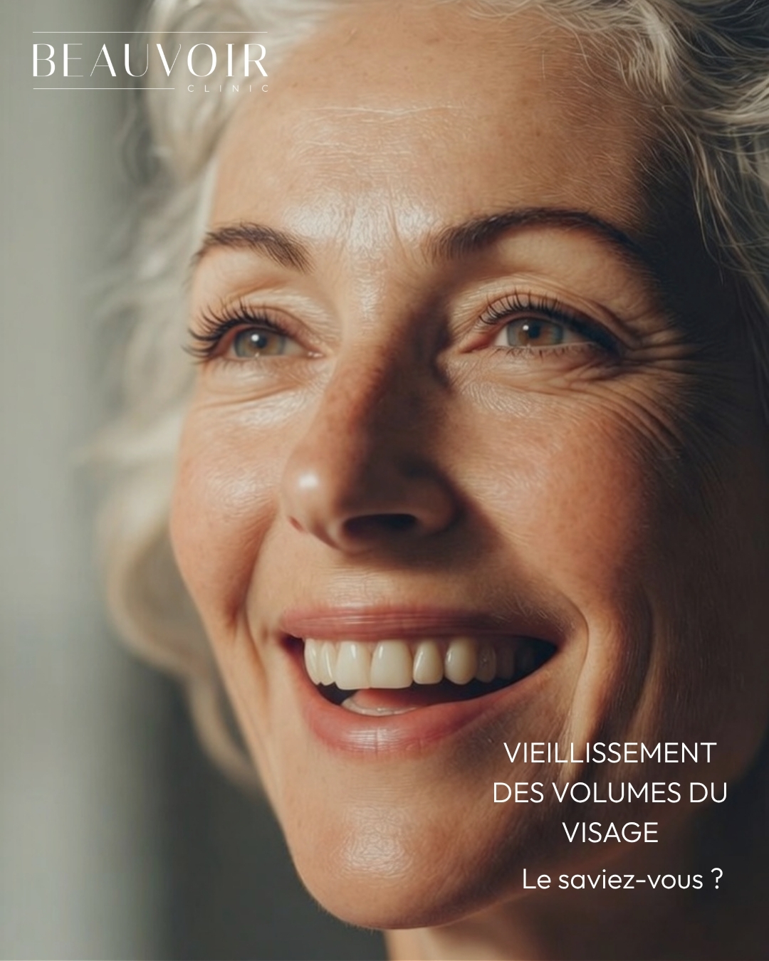 Beauvoir Clinic — Vieillissement volumes visage